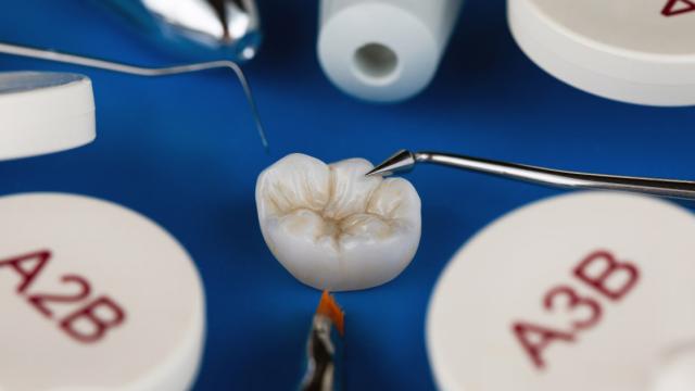intarsio dentale cover