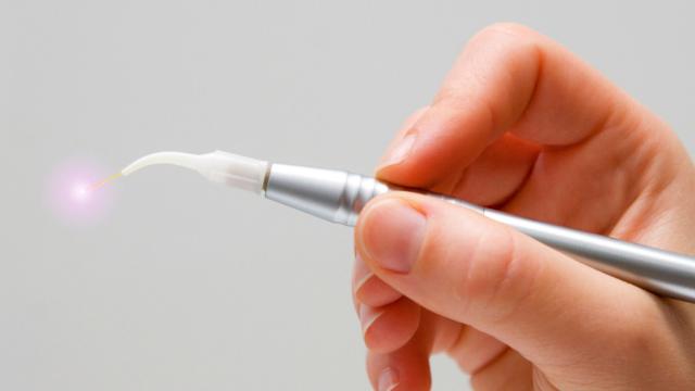 laser odontoiatria