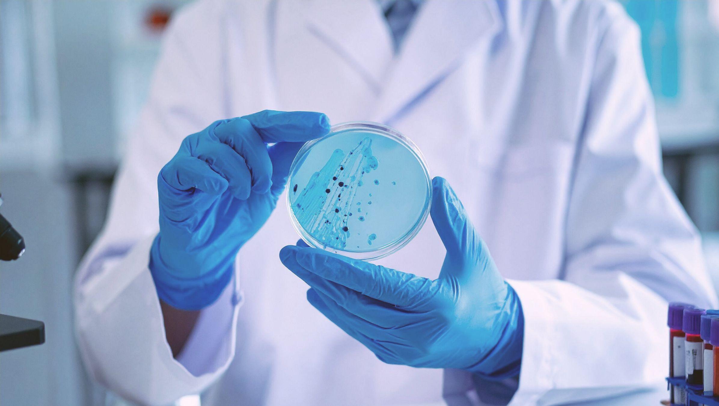 Placca batterica: cos’è, cause e come rimuoverla