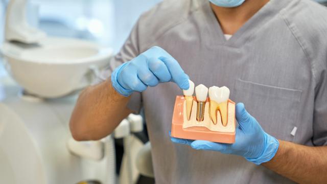 cover implantologia con poco osso