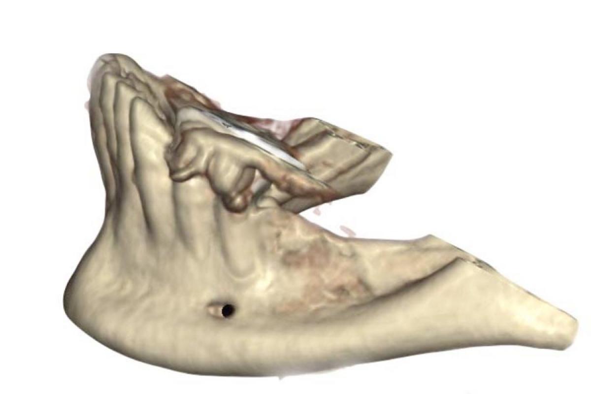 Lamina Corticale
