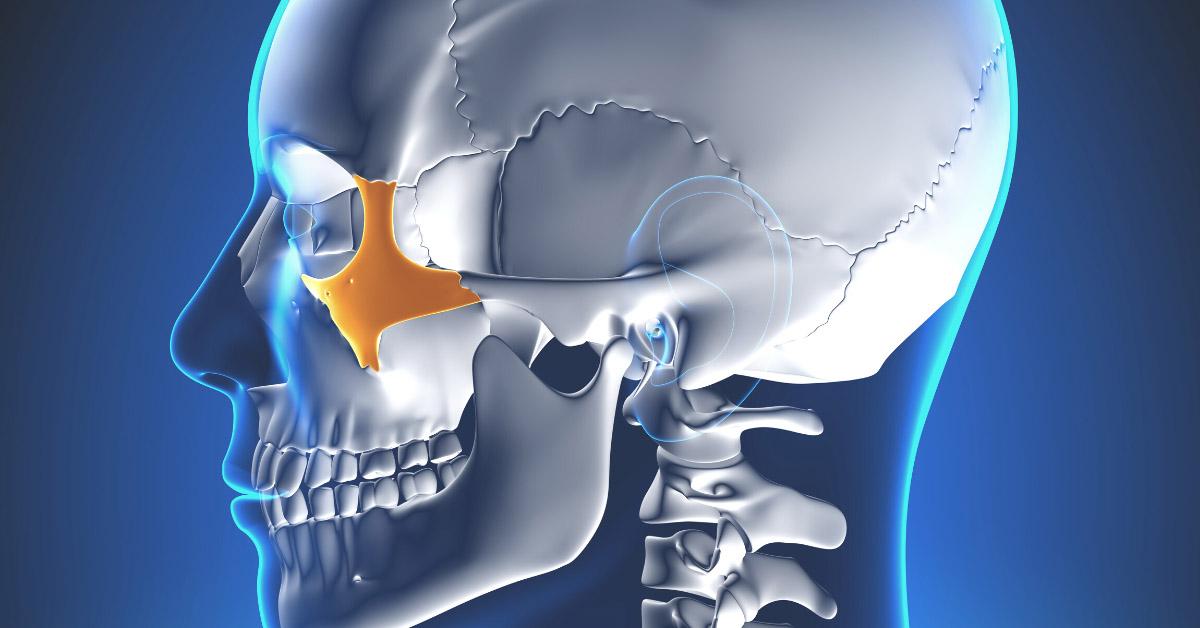 Impianti Zigomatici indicazioni e controindicazioni