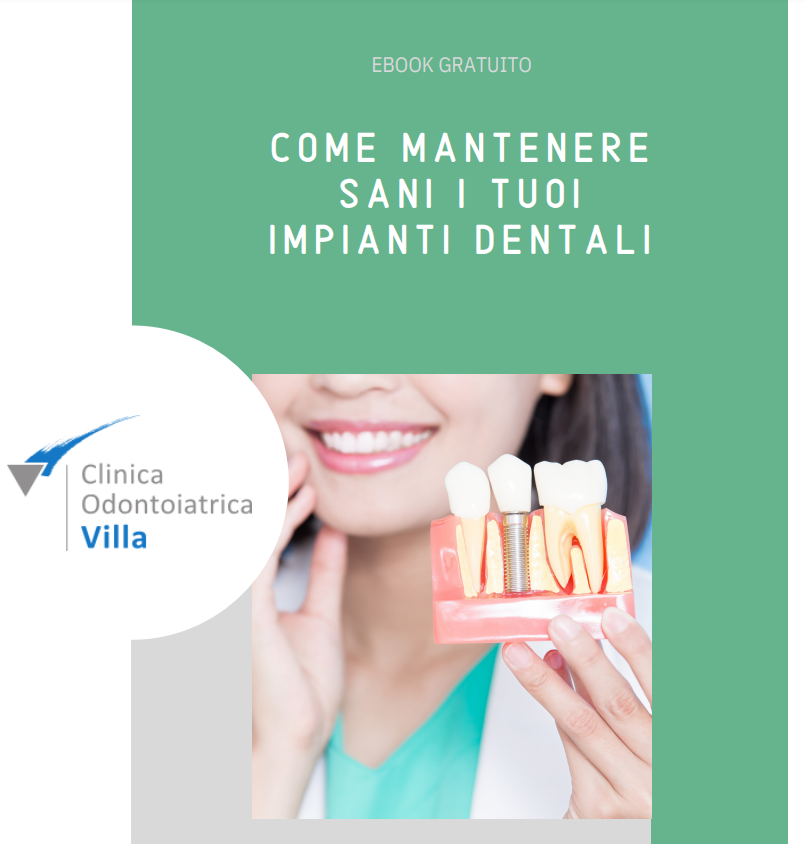 ebook come mantenere sani i tuoi impianti dentali