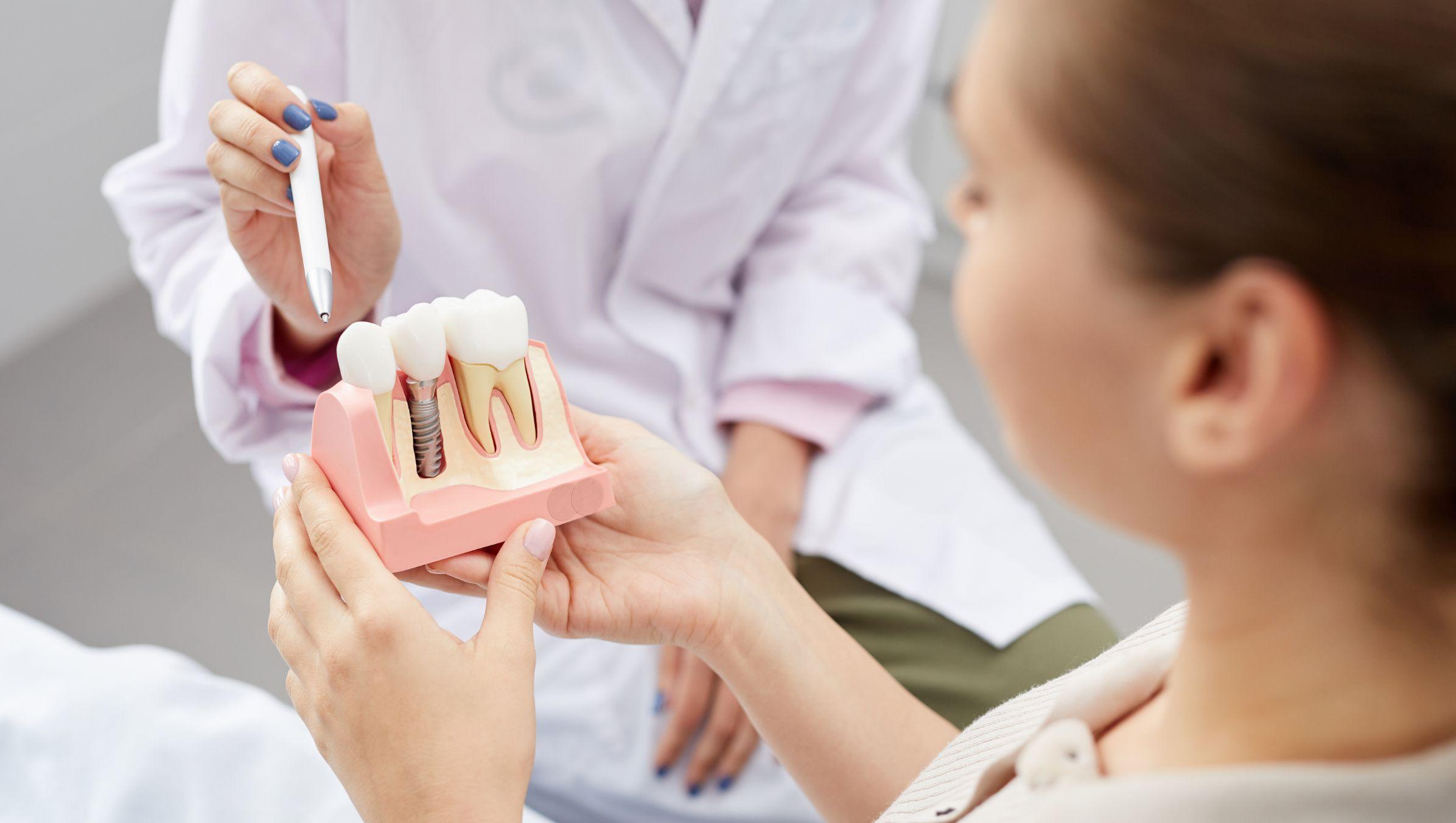 Implantologia dentale: la guida completa aggiornata 2025