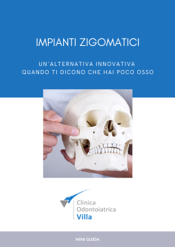 recessioni gengivali ebook
