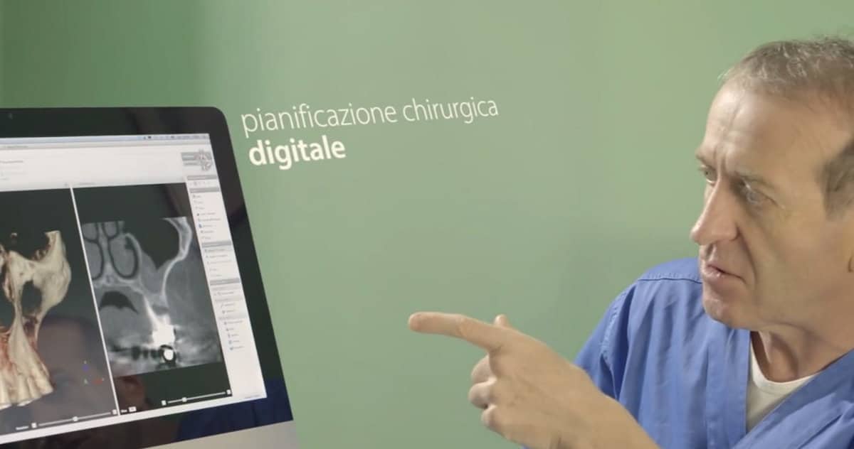 La pianificazione chirurgica digitale