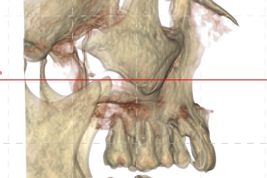 diagnosi computer guidata