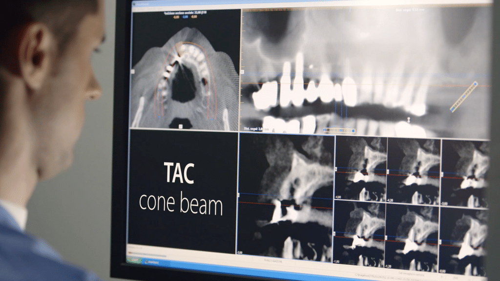 tac cone beam