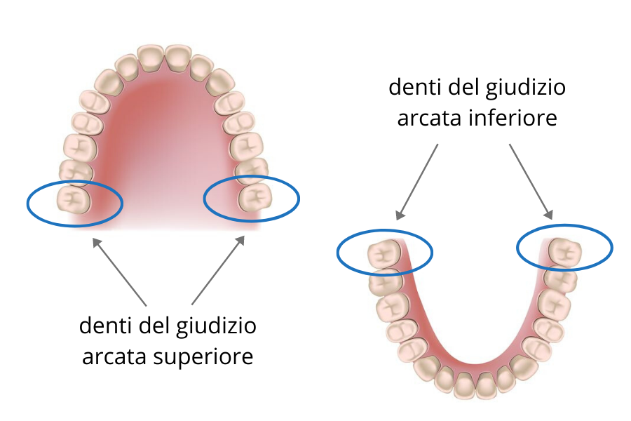 denti del giudizio schema