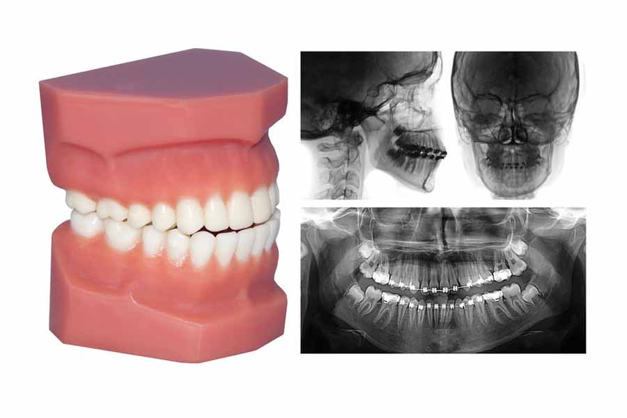 malocclusione diagnosi visiva e con radiografie