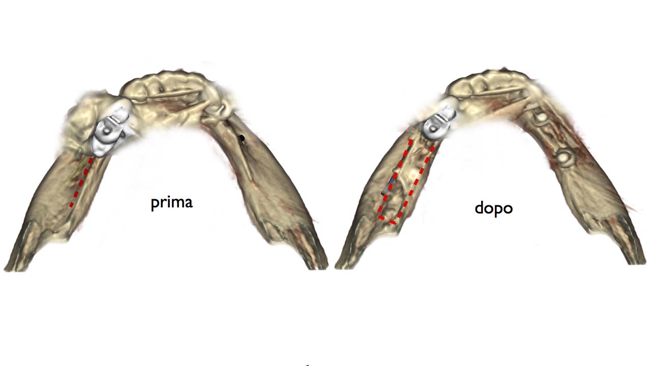 lamina corticale