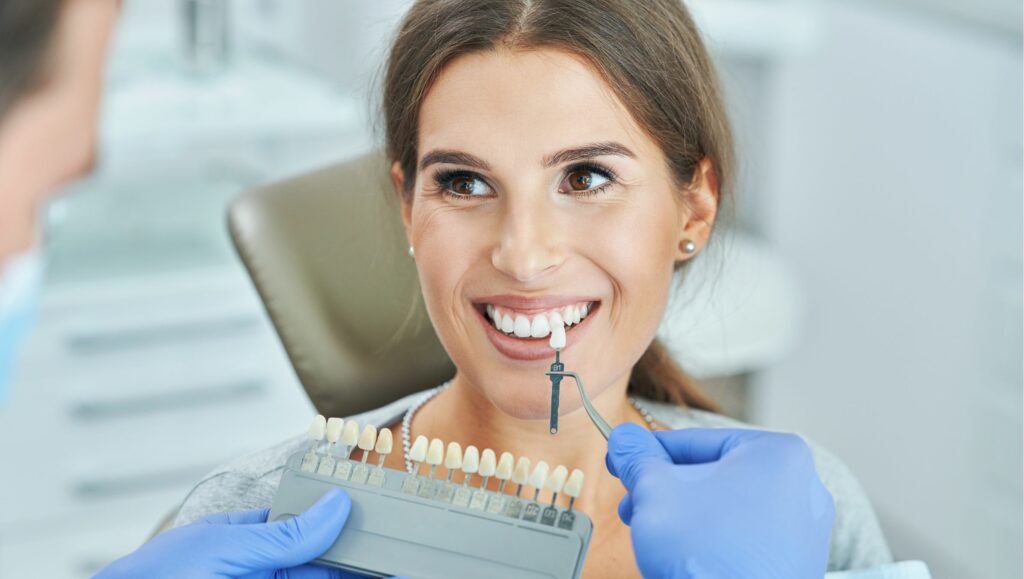 cover sbiancamento dentale