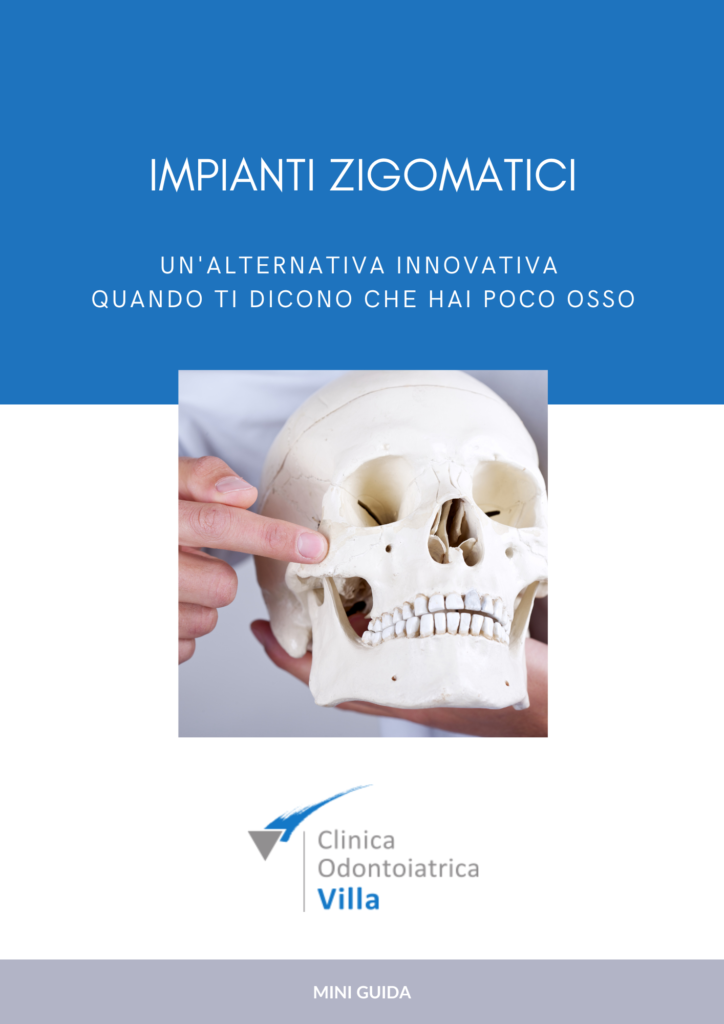 ebook impianti zigomatici