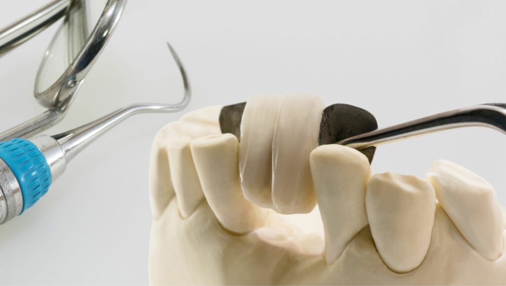 Maryland dentale