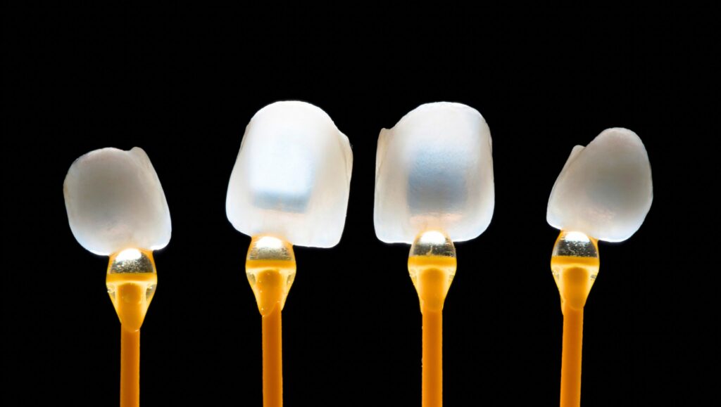 faccette dentali preparazione odontotecnico