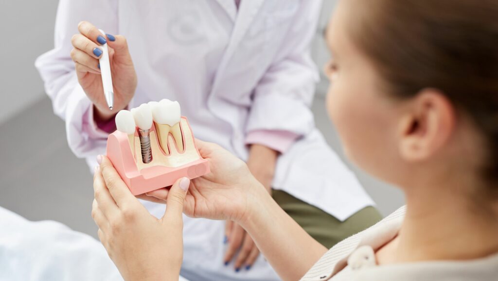 cover implatologia dentale