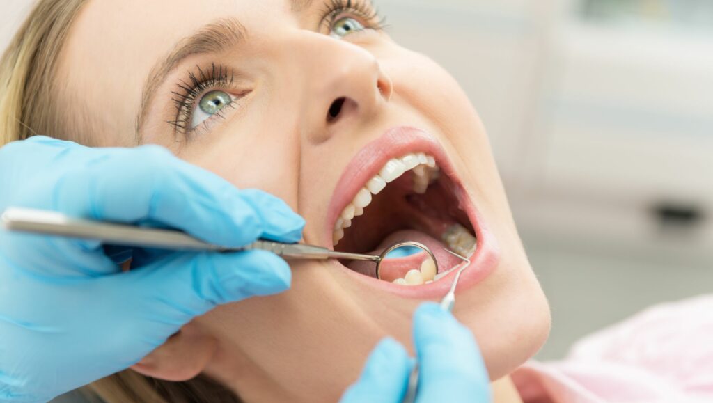 cover intarsio dentale