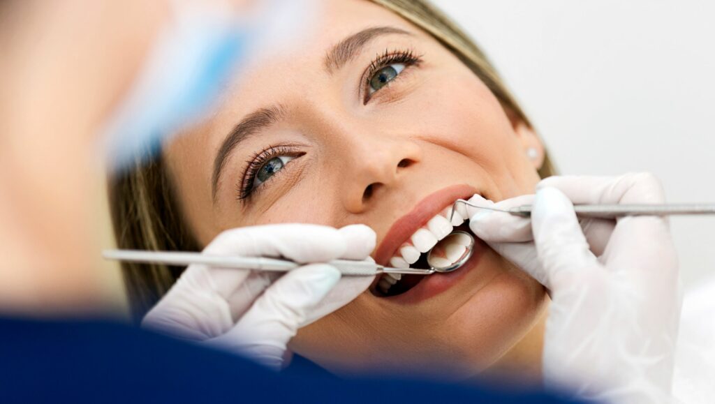 cover faccette dentali