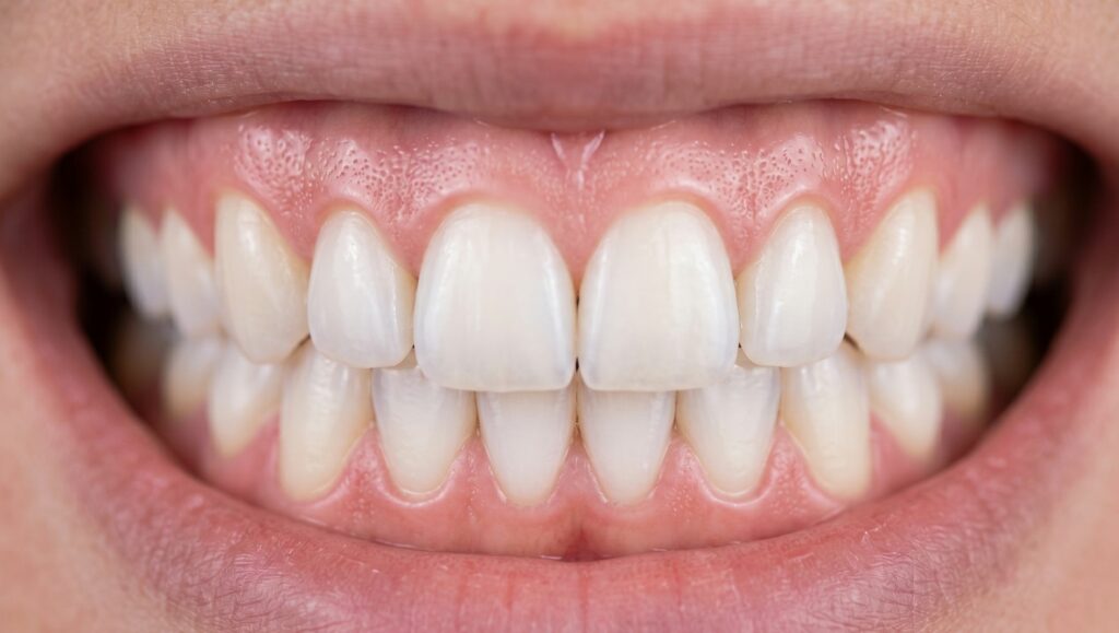 Gengive sane e rosa attorno a denti bianchi perfettamente puliti.
